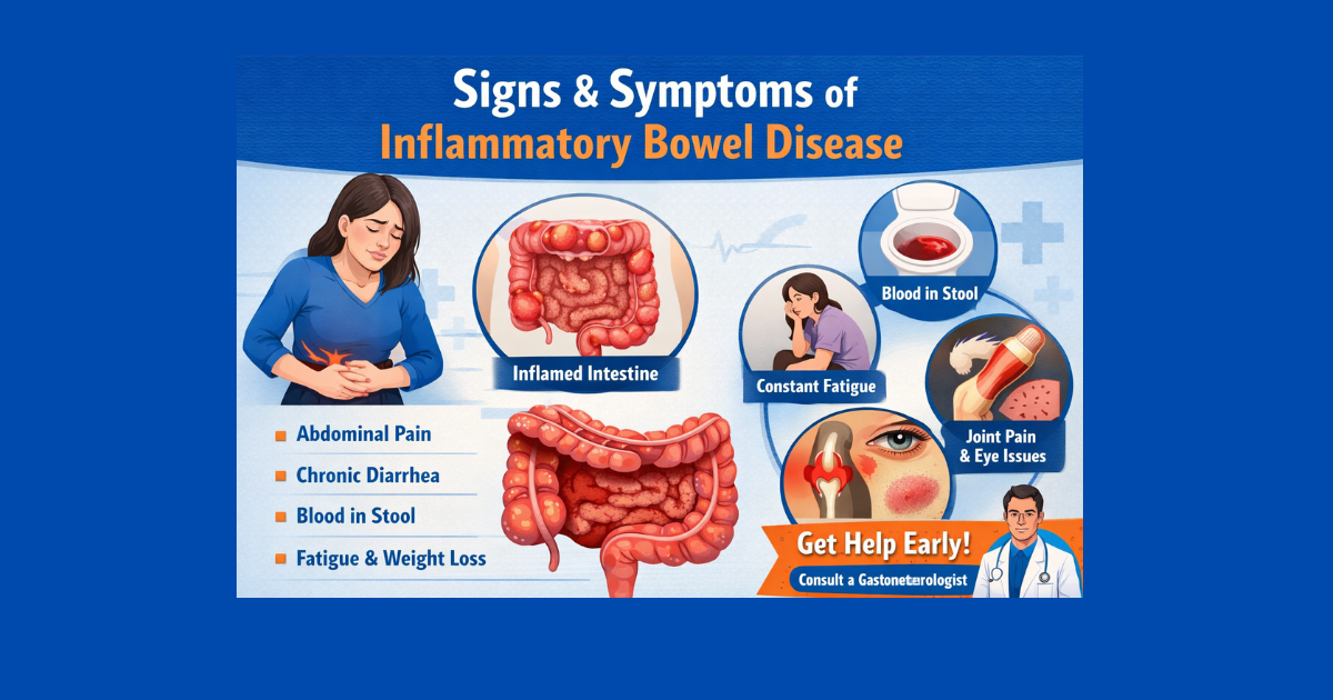 What Are the Signs and Symptoms of Inflammatory Bowel Disease? |...
